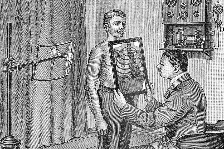 Первые опыты с обследования лёгких.