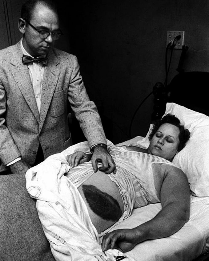 Потерпевшая, которую поразил метеорит, 1954 год Доктор Муди...